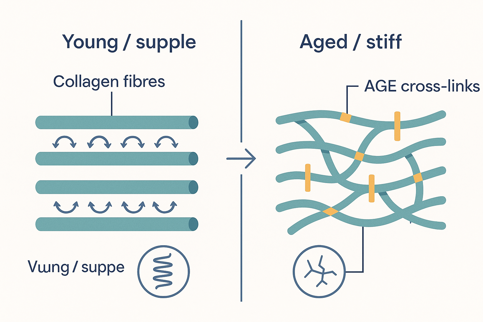 Two bundles of collagen fibres side by side: on the left, supple parallel fibres able to slide and spring back; on the right, the same fibres welded together by amber AGE cross-links into a stiff, brittle, disorganised mesh