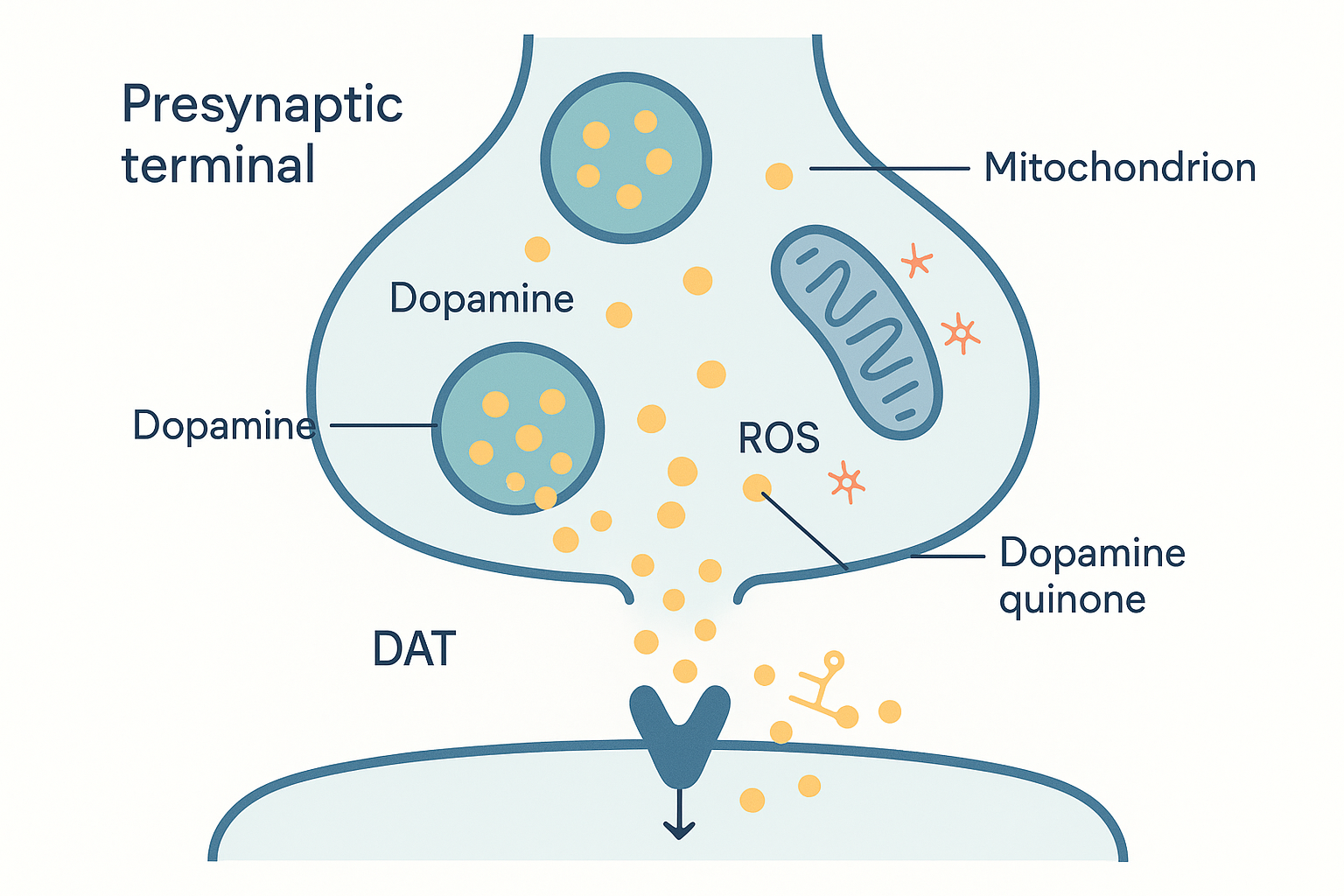 A dopaminergic nerve terminal under amphetamine: the DAT transporter running in reverse, dopamine spilling out of ruptured vesicles into the cytoplasm where free dopamine molecules oxidise into quinones and release reactive-oxygen-species sparks, with stressed mitochondria nearby