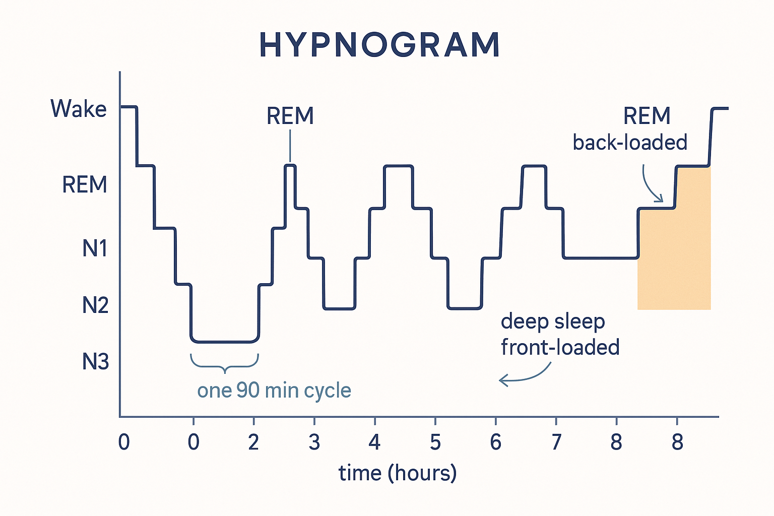 A hypnogram: a step-graph plotting sleep stage on the vertical axis (Wake, REM, N1, N2, N3 from top to bottom) against time across about eight hours on the horizontal axis, showing four to five roughly ninety-minute cycles, with deep N3 troughs concentrated in the first half of the night and progressively longer REM plateaus rising toward the morning, plus a few brief awakenings